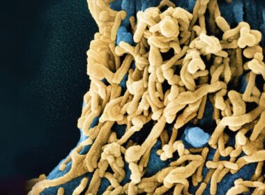 a close up of a blue and yellow substance