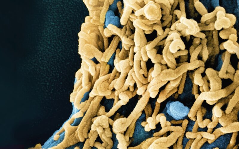 a close up of a blue and yellow substance