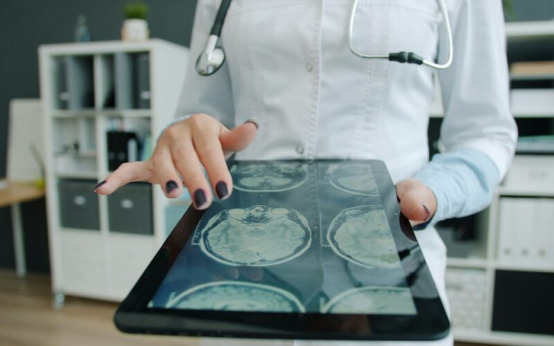 Doctor shows brain scan on tablet in office